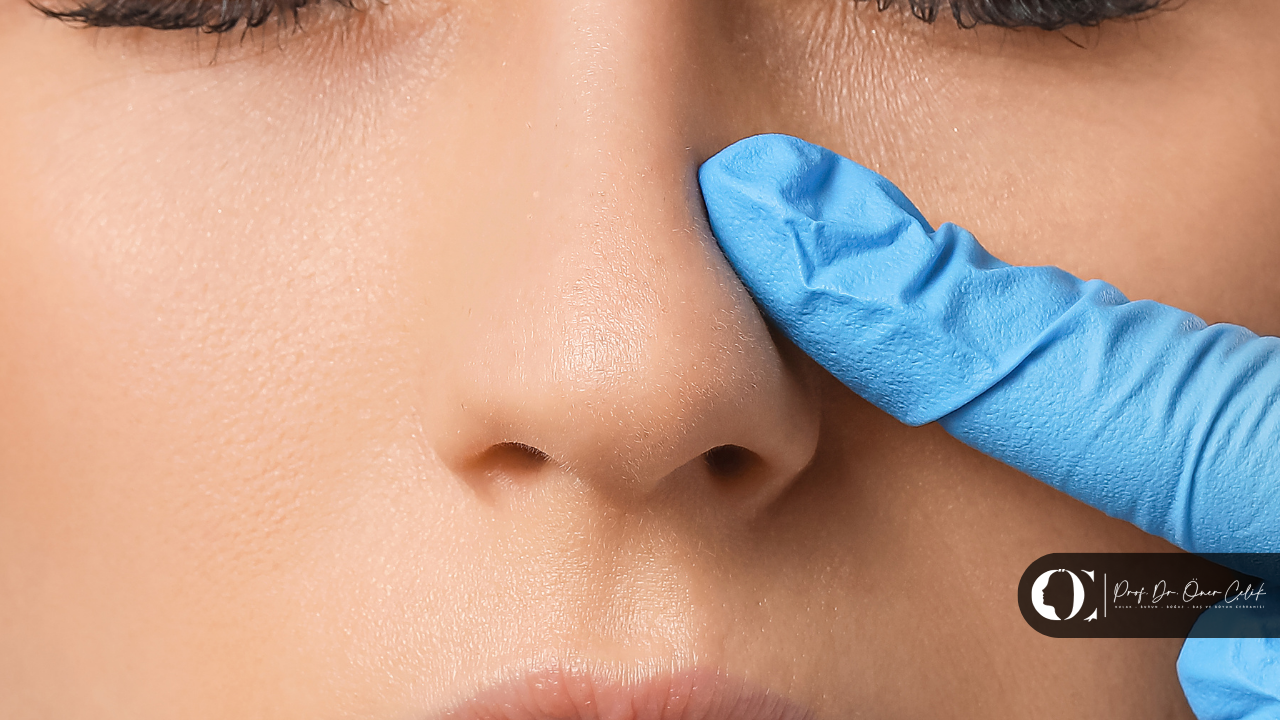 Açık Rinoplasti (Burun Estetiği) Nedir? 5 Açık Rinoplasti