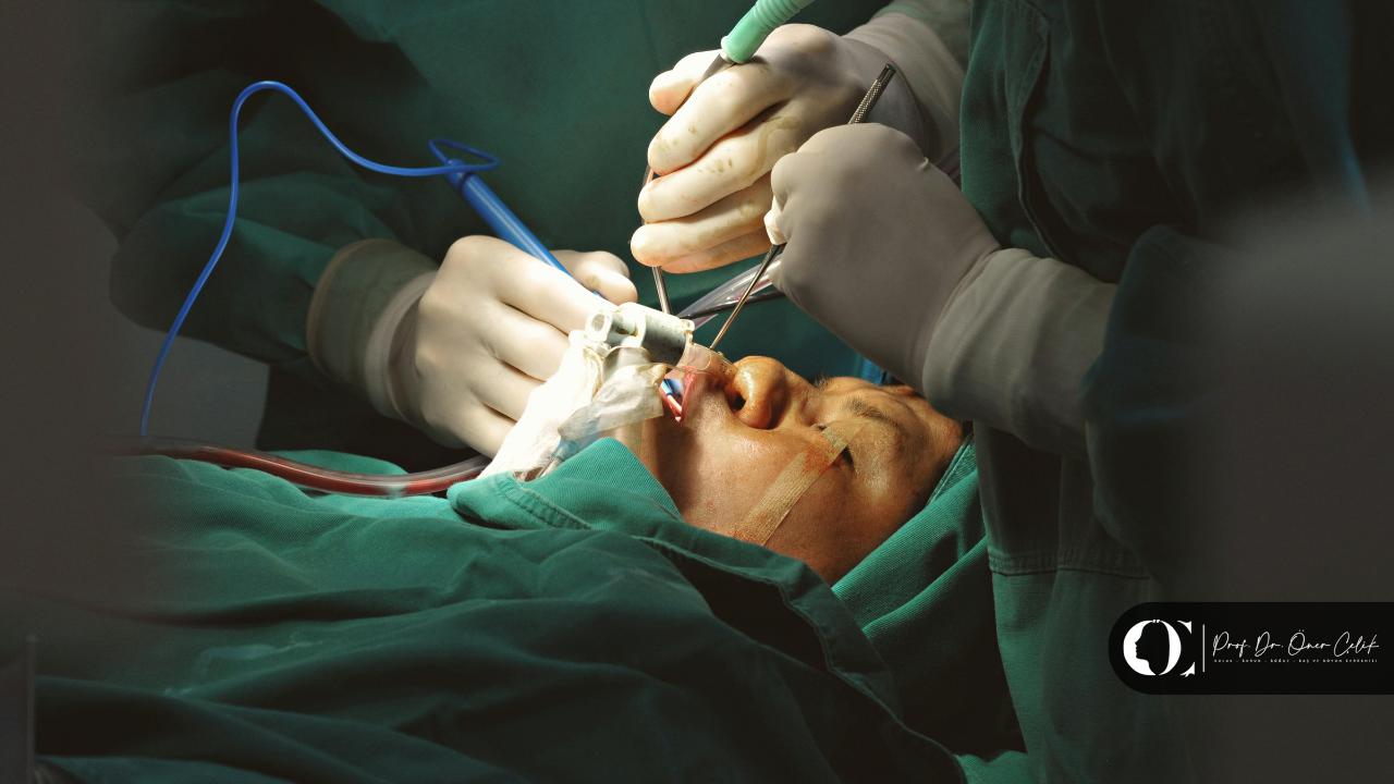 Burun Estetiği kaç saat sürer? 5 Burun Estetiği