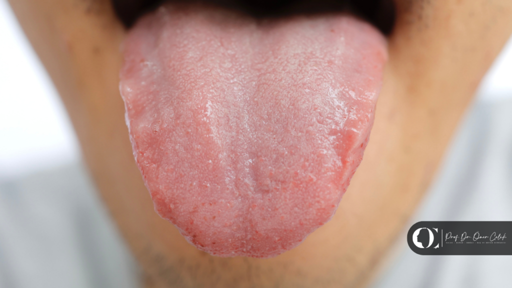 Agiz Ici ve Dil Yaralari Ne Zaman Biyopsi Gerekir