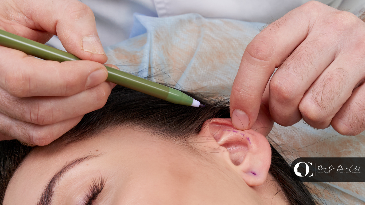 Kepçe Kulak Ameliyatı